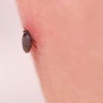 Tick Tips